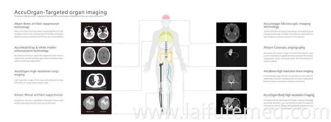 Advanced 512 Slice CT Scanner for Veterinary Imaging-High-Resolution 3D Diagnostics for Large Animals